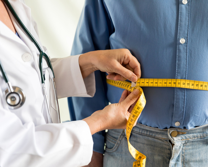 Weight Loss